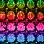 The X-ray of the human brain